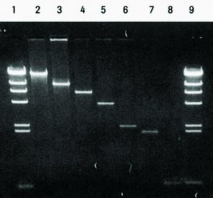 Agarose Gel DNA Extraction Kit 11696505001