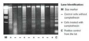 Apoptotic DNA-Ladder Kit 11835246001