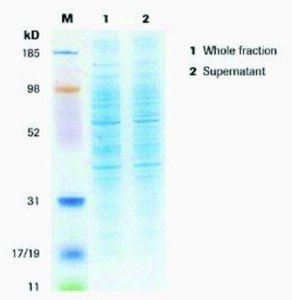 cOmplete Lysis-M 4719956001