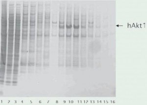 cOmplete, EDTA-free Protease Inhibitor Cocktail 