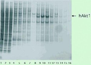 cOmplete, EDTA-free Protease Inhibitor Cocktail 4693132001