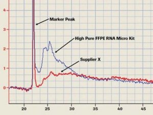 High Pure FFPE RNA Micro Kit 4823125001