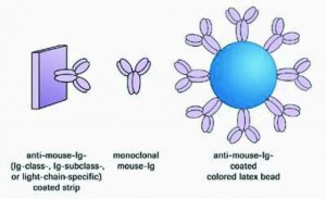 IsoStrip Mouse Monoclonal Antibody Isotyping Kit 11493027001