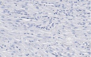 Anti--Actin Antibody, clone 6L12, ZooMAb Rabbit Monoclonal 