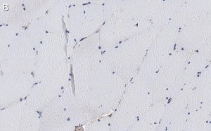 Anti--Dystroglycan Antibody, clone VIA4-1 ZooMAb Mouse Monoclonal 