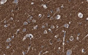 Anti--synuclein Antibody, clone 1D22 ZooMAb Rabbit Monoclonal 