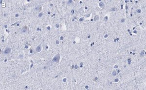 Anti--synuclein Antibody, clone 1D22 ZooMAb Rabbit Monoclonal 