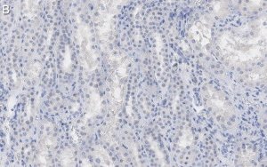 Anti--Tubulin Antibody, clone DM1A ZooMAb Mouse Monoclonal 