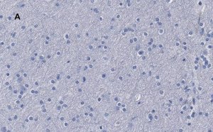 Anti--Tubulin III Antibody, clone 5H16, ZooMAb Rabbit Monoclonal 