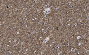 Anti--Tubulin III Antibody, clone 5H16, ZooMAb Rabbit Monoclonal 