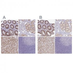 Anti-A1CF antibody produced in rabbit 