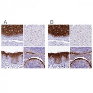 Anti-A2ML1 antibody produced in rabbit 
