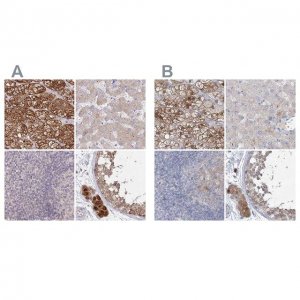 Anti-AAMDC antibody produced in rabbit 