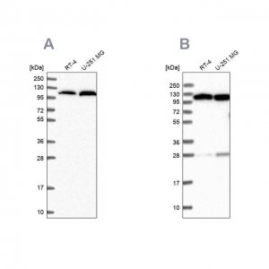 Anti-AARS antibody produced in rabbit HPA044223-100UL