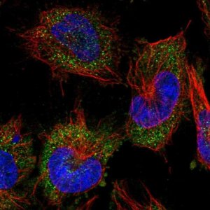 Anti-AARS antibody produced in rabbit HPA044223-100UL