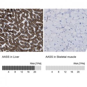 Anti-AASS antibody produced in rabbit 