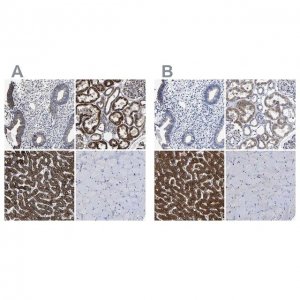 Anti-AASS antibody produced in rabbit 