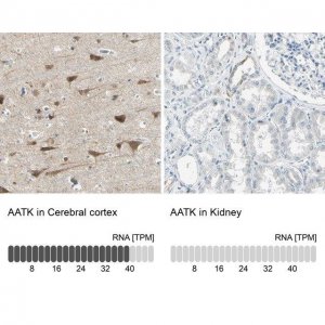 Anti-AATK antibody produced in rabbit 