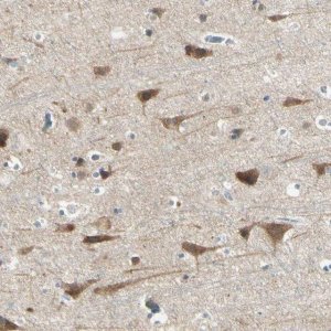 Anti-AATK antibody produced in rabbit 