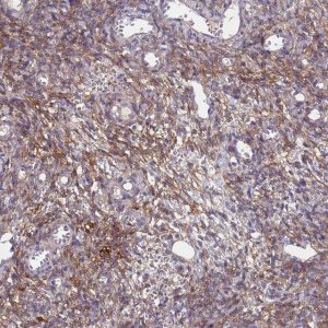 Anti-ABCA8 antibody produced in rabbit 