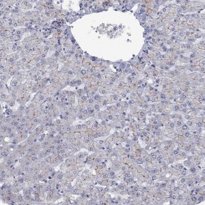 Anti-ABCB4 antibody produced in rabbit 