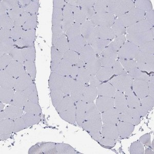 Anti-ABCB4 antibody produced in rabbit 