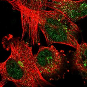 Anti-ABCB6 antibody produced in rabbit 
