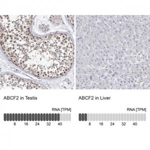 Anti-ABCF2 antibody produced in rabbit HPA030388-100UL