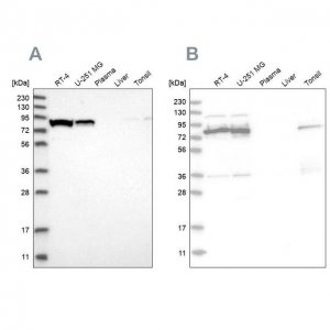 Anti-ABCF2 antibody produced in rabbit HPA030388-100UL