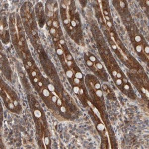 Anti-ABHD11 antibody produced in rabbit 
