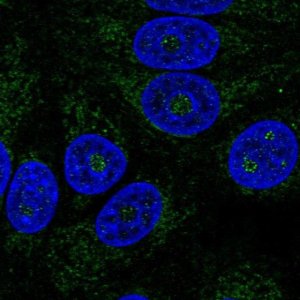 Anti-ABHD11 antibody produced in rabbit 