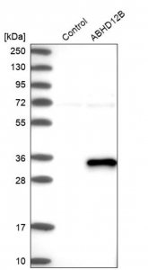 Anti-ABHD12B antibody produced in rabbit 