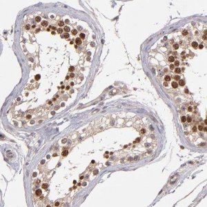 Anti-ABHD12B antibody produced in rabbit 