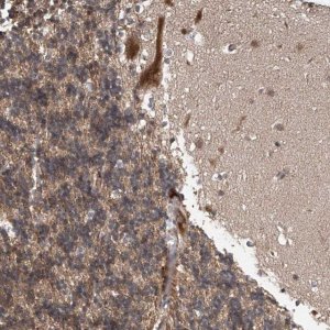 Anti-ABHD13 antibody produced in rabbit 