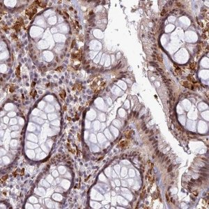 Anti-ABHD17A antibody produced in rabbit HPA043270-100UL