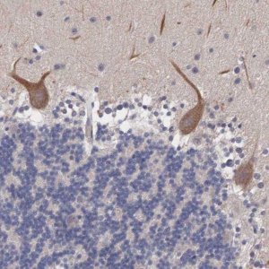 Anti-ABHD4 antibody produced in rabbit 