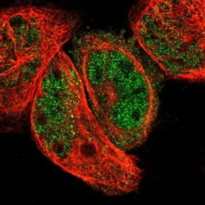 Anti-ABHD4 antibody produced in rabbit 