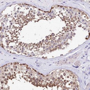 Anti-ABHD5 antibody produced in rabbit 