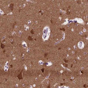 Anti-ABI2 antibody produced in rabbit 