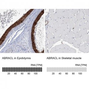 Anti-ABRACL antibody produced in rabbit 