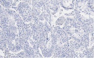 Anti-Ac--Tubulin (Lys40) Antibody, clone 1L10, ZooMAb Rabbit Monoclonal 