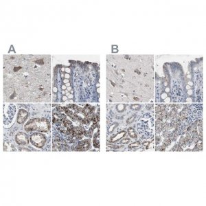 Anti-ACAA1 antibody produced in rabbit 