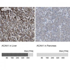 Anti-ACAA1 antibody produced in rabbit 