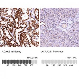 Anti-ACAA2 antibody produced in rabbit HPA042303-100UL