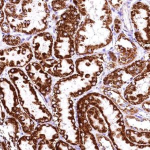 Anti-ACAA2 antibody produced in rabbit HPA042303-100UL