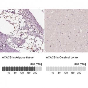 Anti-ACACB antibody produced in rabbit 