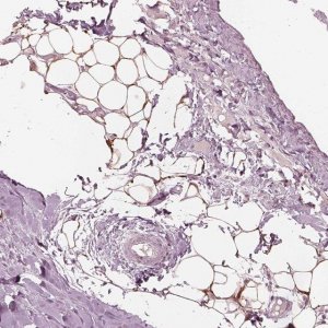Anti-ACACB antibody produced in rabbit 
