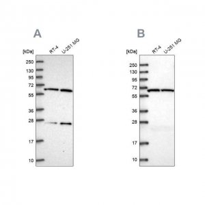 Anti-ACAD9 antibody produced in rabbit 