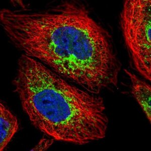 Anti-ACAD9 antibody produced in rabbit 