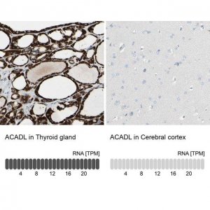 Anti-ACADL antibody produced in rabbit 
